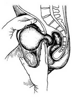 Диагностика беременности