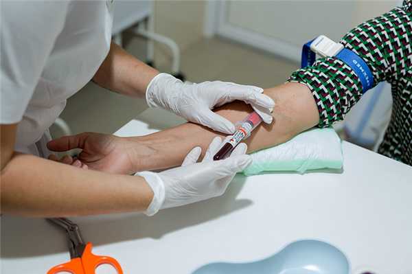 You are currently viewing Анализ на альдостерон - гормон надпочечников