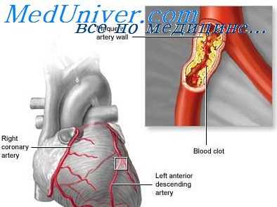 клиника ибс при алкоголизме