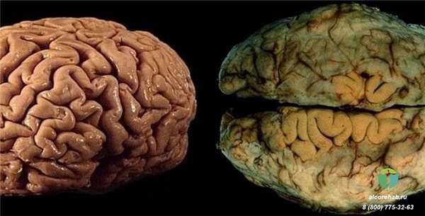 Как влияет алкоголь на мозг?