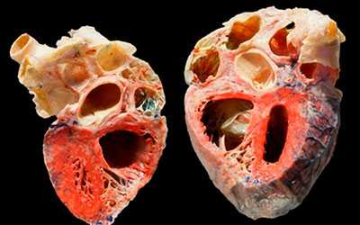 Влияние алкоголя на сердце - Угодие