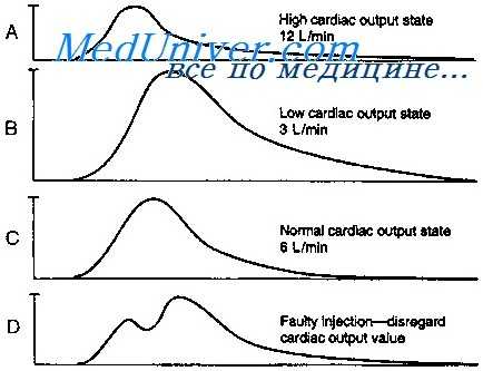 коронарный кровоток
