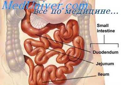 окклюзия верхней брыжеечной артерии