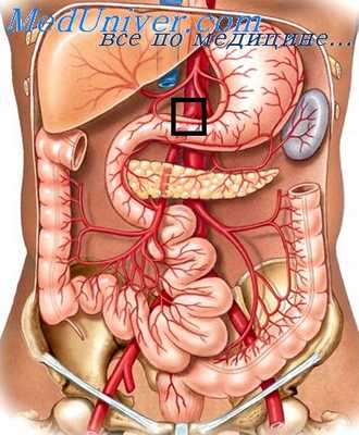 окклюзия верхней брыжеечной артерии