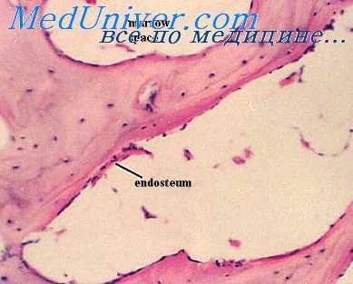 кость после облучения