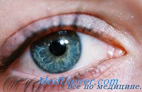 изменения хрусталика глаза