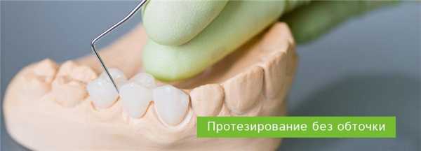 Что такое протезирование без обточки и почему оно предпочтительнее?