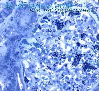 кроветворные органы