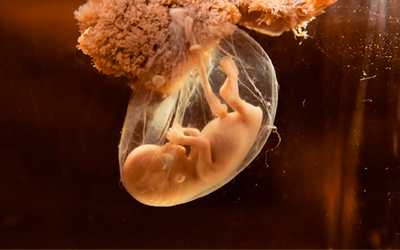 Последствия для ребенка - Веримед