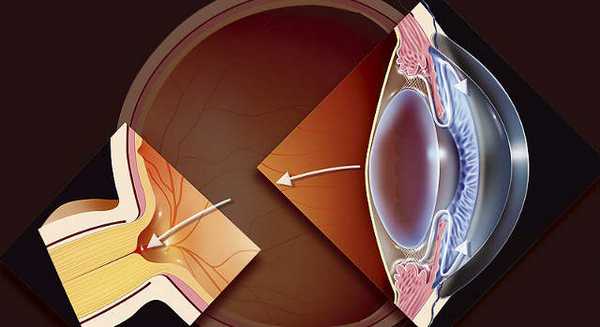 глазное давление при глаукоме - норма