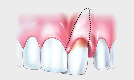 Травма, удар