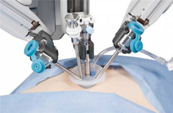 Дренирование желчного пузыря и желчных протоков