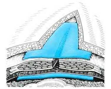 operatciia_gernioplastiki_bez_natiazheniia