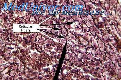 торфяное дубление