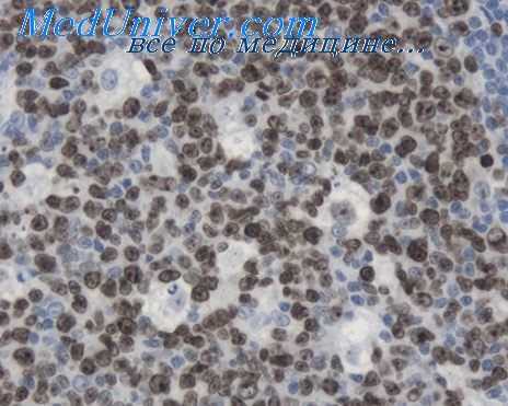 сапонификация