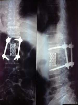 фиксация 360 градусов