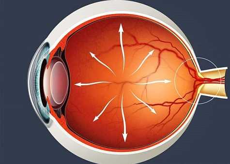 Глазное давление при глаукоме
