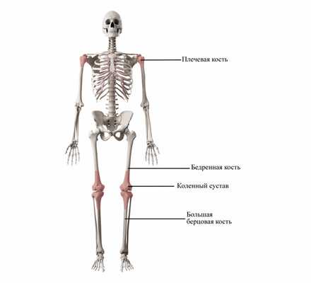 остеосаркома скелет.jpg