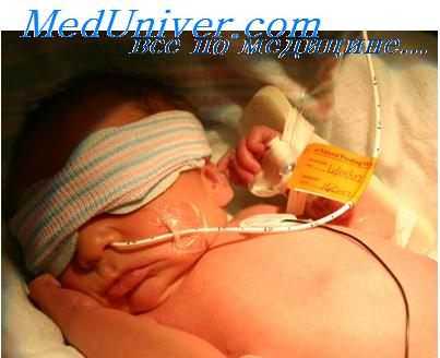 желтуха у ребенка