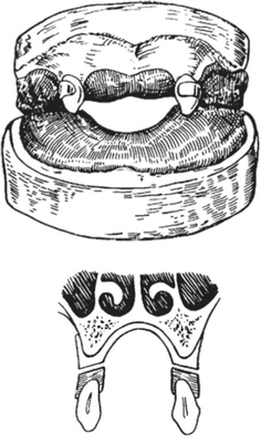 Шина Гуннинга