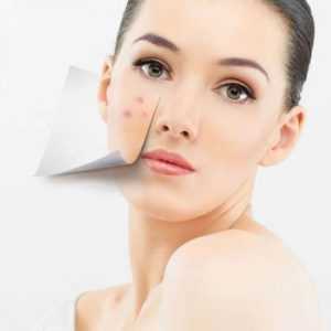 Аллергические заболевания