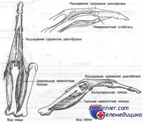 переломы фаланг пальцев кисти