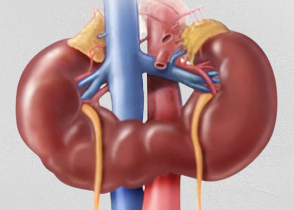 Врожденные аномалии мочеточника