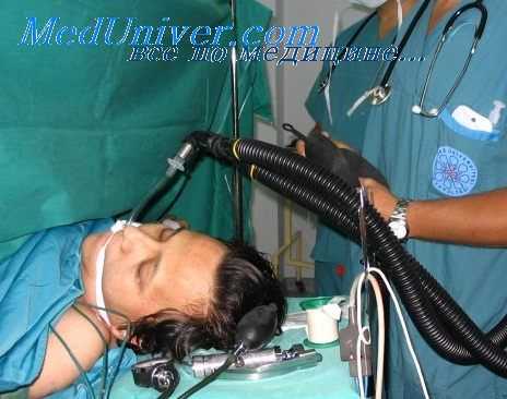 ингаляционная анестезия