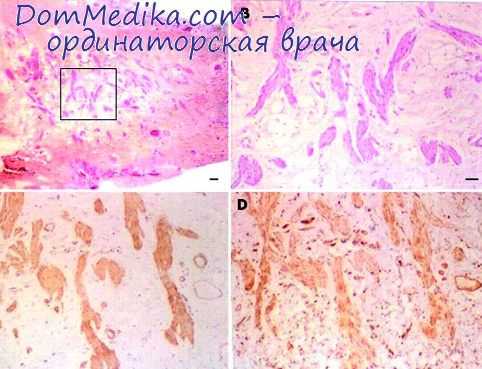 обмен ионов почками