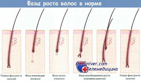 Фазы роста волос в норме