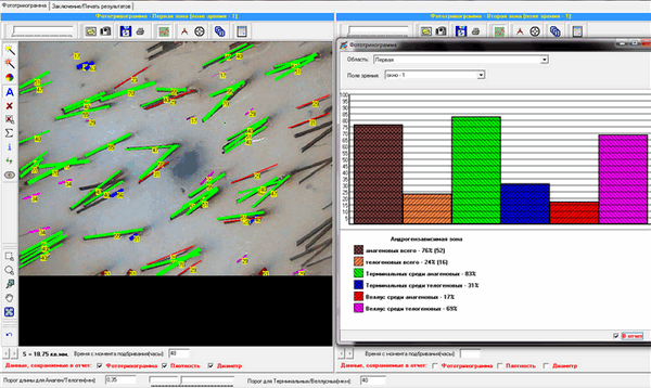 Фототрихограмма