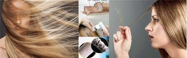 Диагностика выпадения волос и заболеваний кожи головы