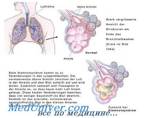 диффузные болезни соединительной ткани