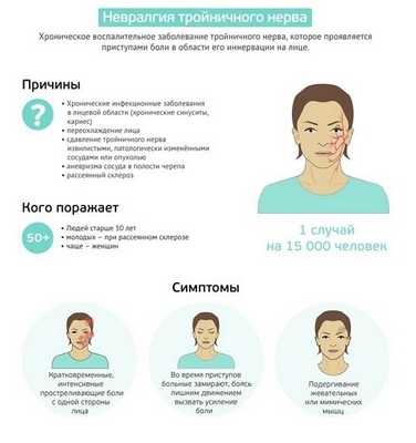 невралгия тройничного нерва