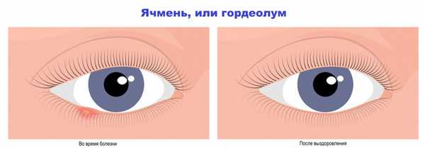 До и после.jpg