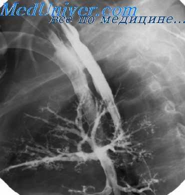 рак пищевода