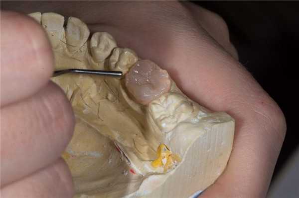 Фиксация монтаж вкладки