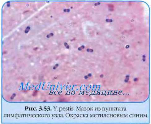 Возбудитель чумы