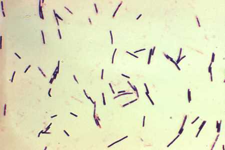 Клостридии перфрингенс (лат. Clostridium perfringens)