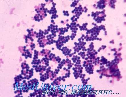 золотистый стафилококк S. aureus MRSA