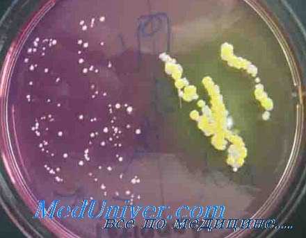 назокомиальные инфекции