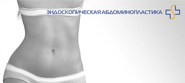фото - эндоскопическая абдоминопластика