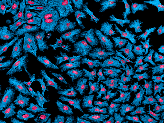 Клеточная линия HeLa