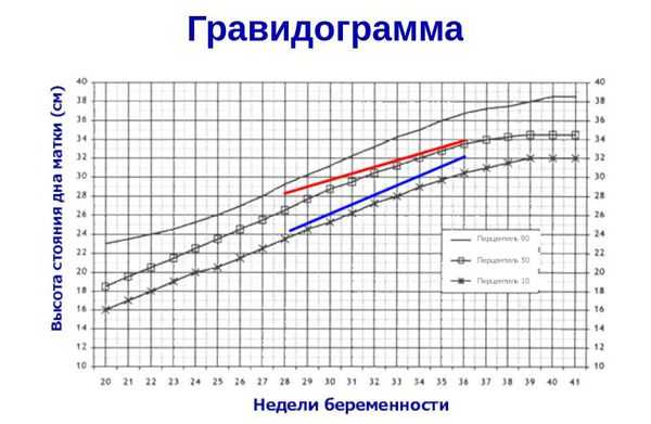 Гравидограмма