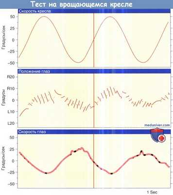 Тест вращательного кресла