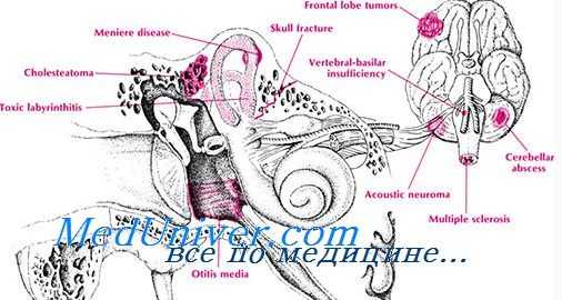 вращательная проба