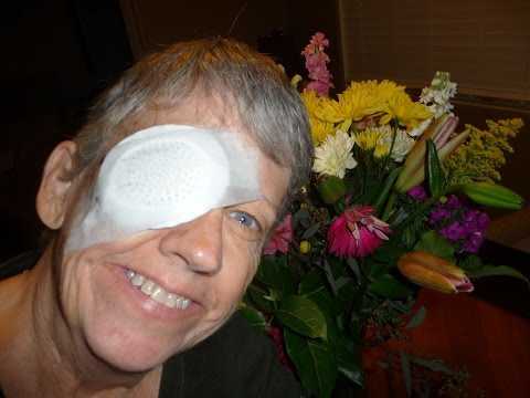 Видео Осложнения операции по удалению хрусталика