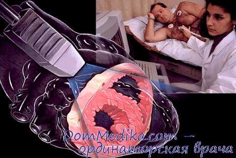 диастолическая функция левого желудочка