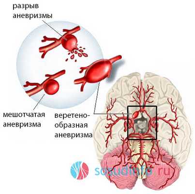 94509684958609485098908