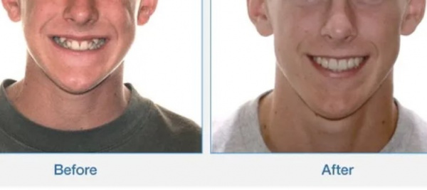 Результыт коррекции